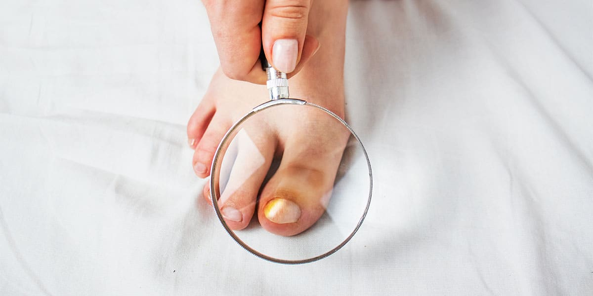 Dermatologista avaliando o pé - site Episense clínica de medicina estética facial e corporal em Matosinhos, Porto - Portugal