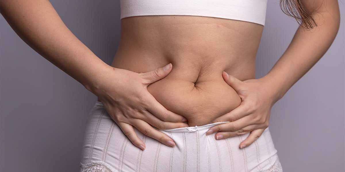 Mulher mostrando a gordura localizada - site Episense clínica de medicina estética facial e corporal em Matosinhos, Porto - Portugal